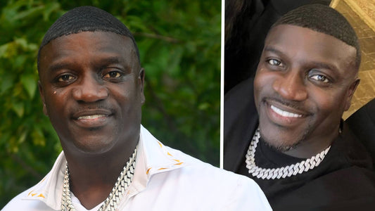 Akon's Hairline Transformation: A Closer Look and Analysis